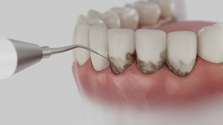Trusted Invisalign Clear Aligners service in Flushing, MI - Dentist Open Now
